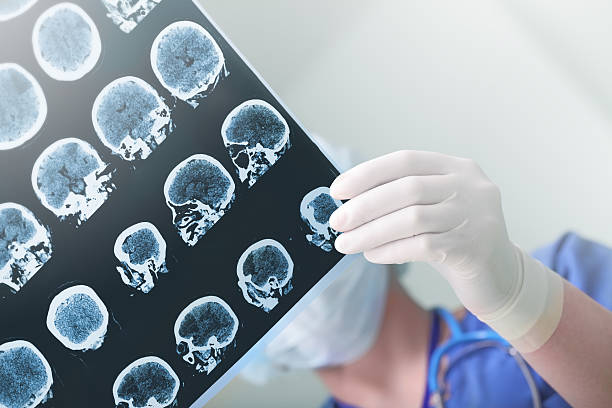 best seizure treatment in ghatkopar mumbai